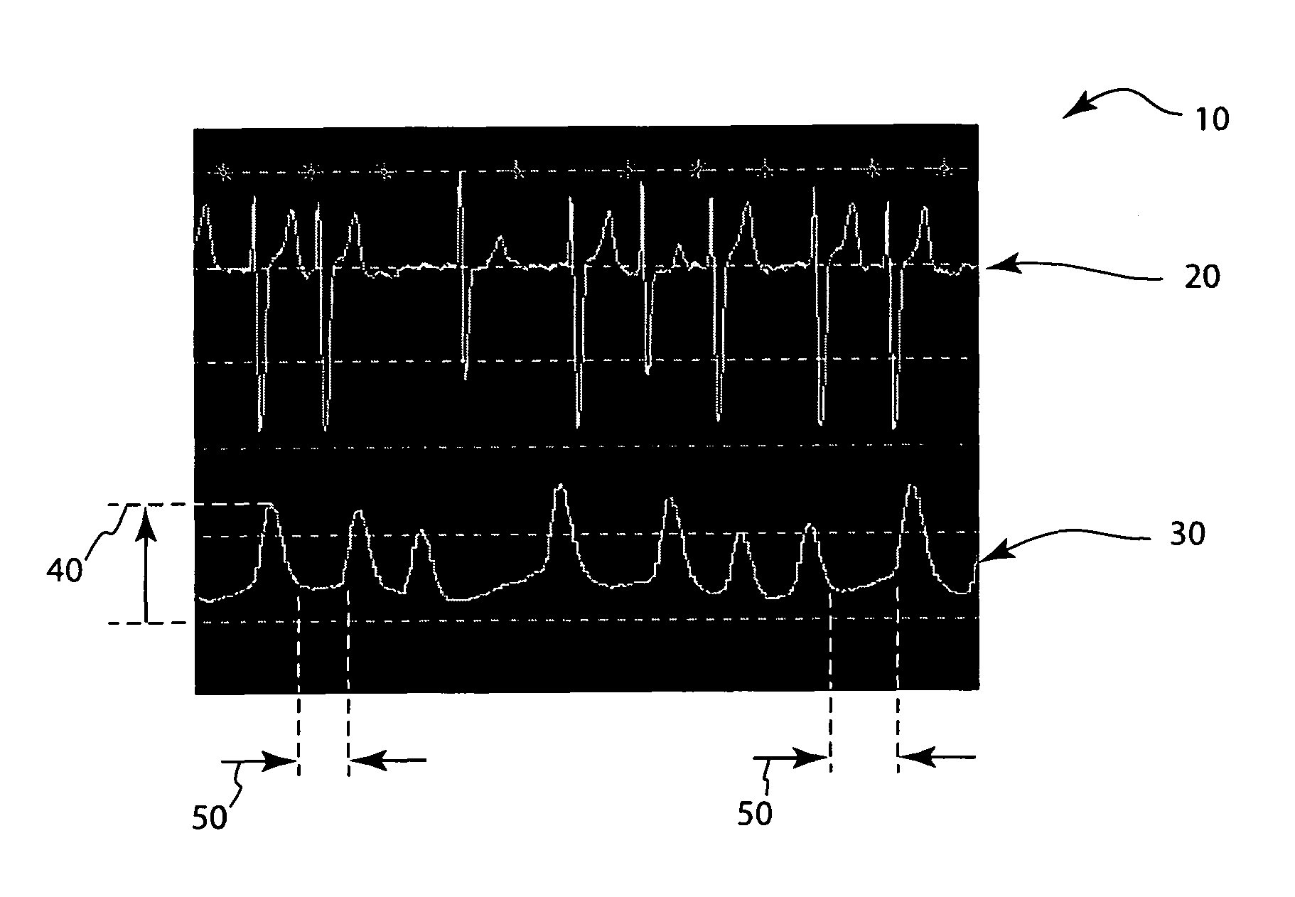 Atrial fibrillation detection using SPO2