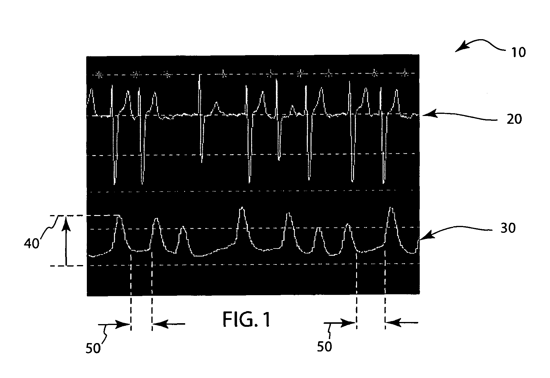 Atrial fibrillation detection using SPO2