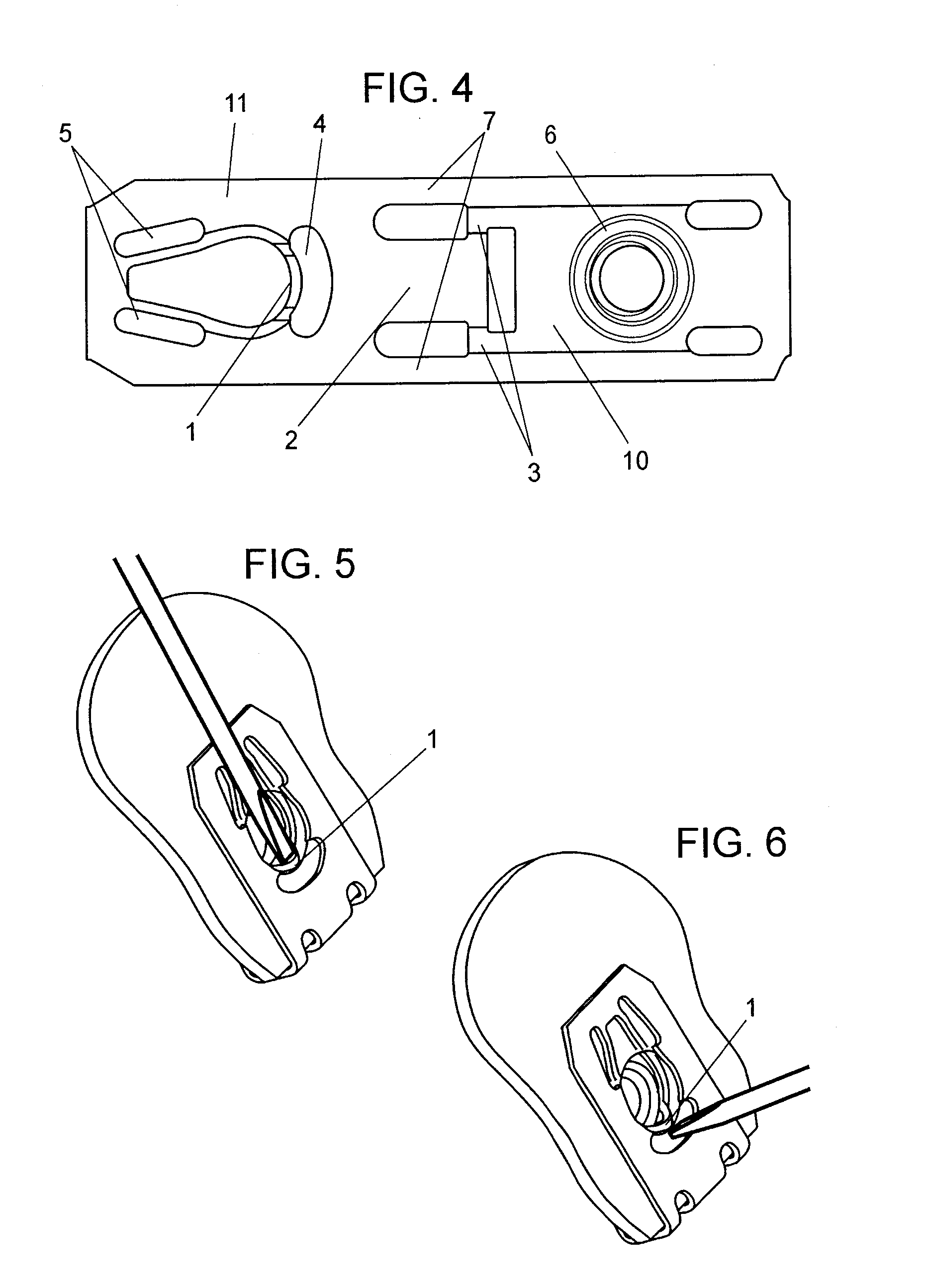 Removable long-lived and reusable u-shaped hybrid nut