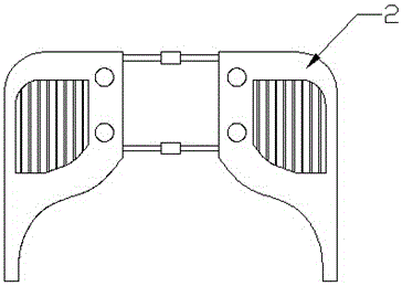 a rib fixator