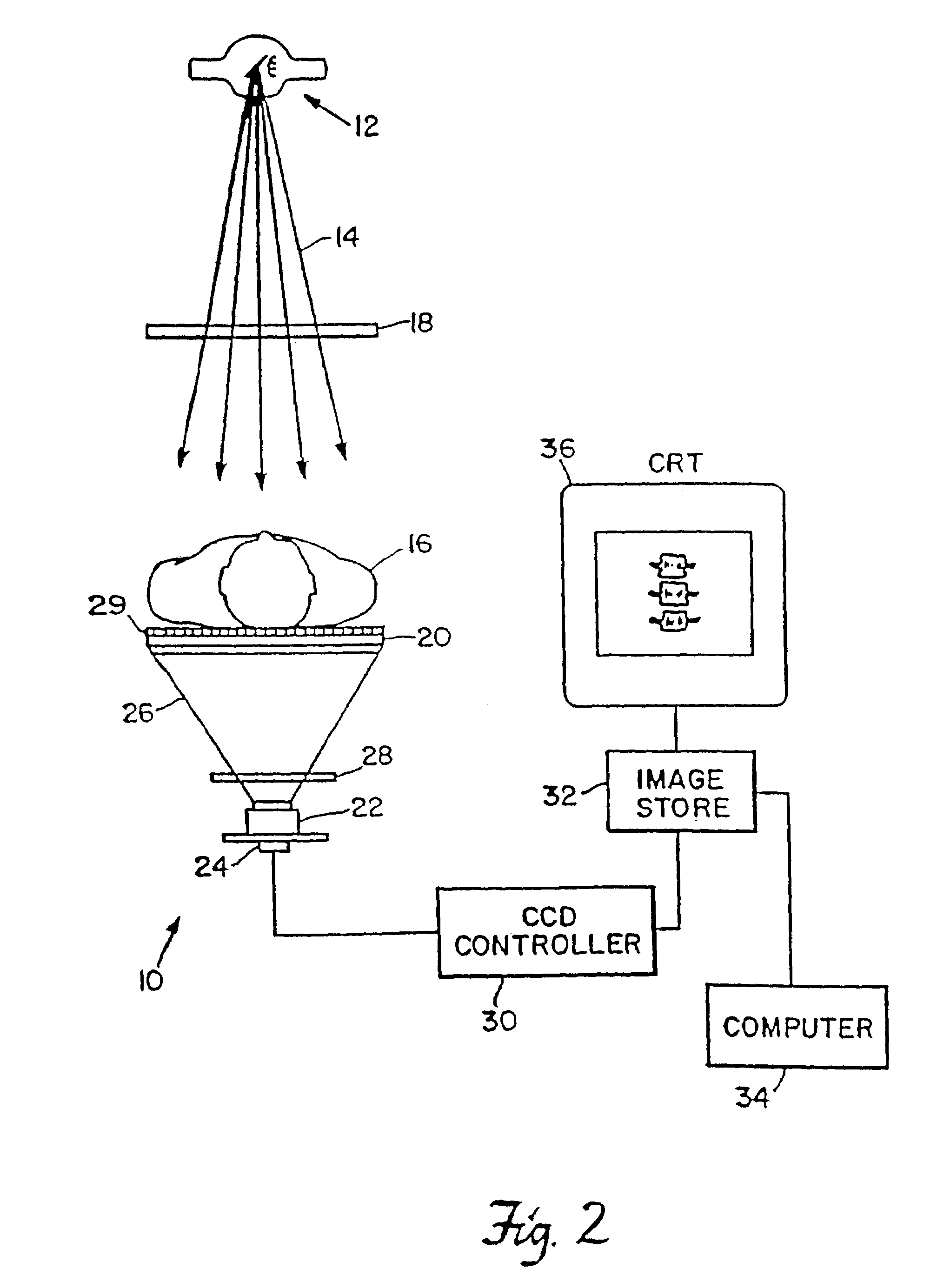 System for quantitative radiographic imaging