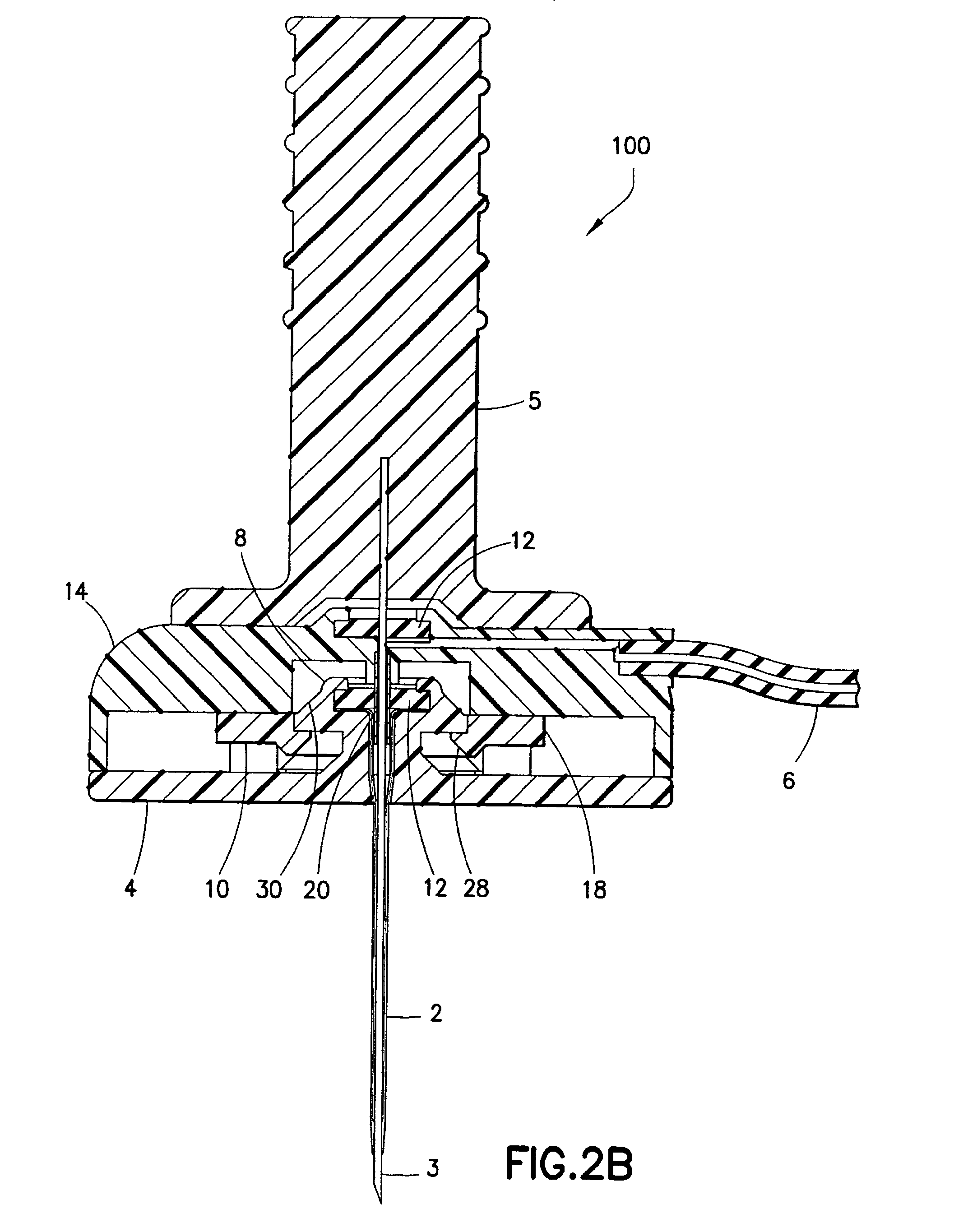 Separatable infusion set with cleanable interface and straight line attachment