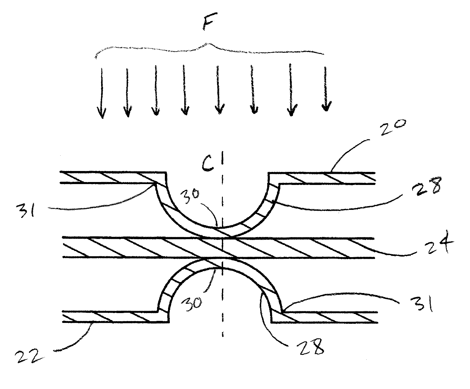 Impact reduction system