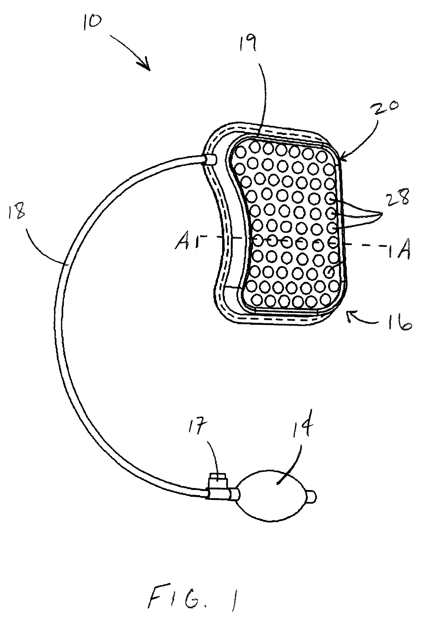 Impact reduction system