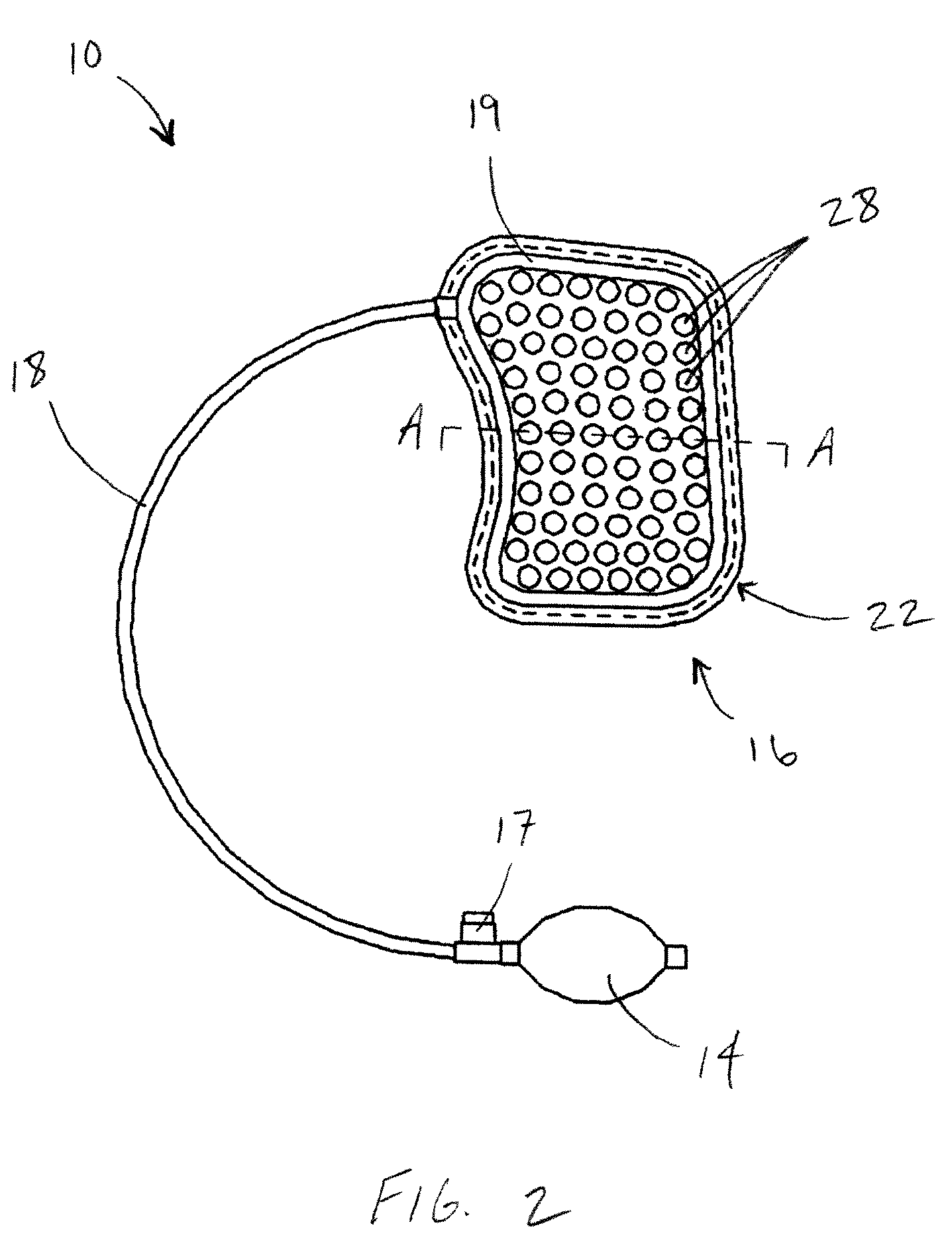 Impact reduction system