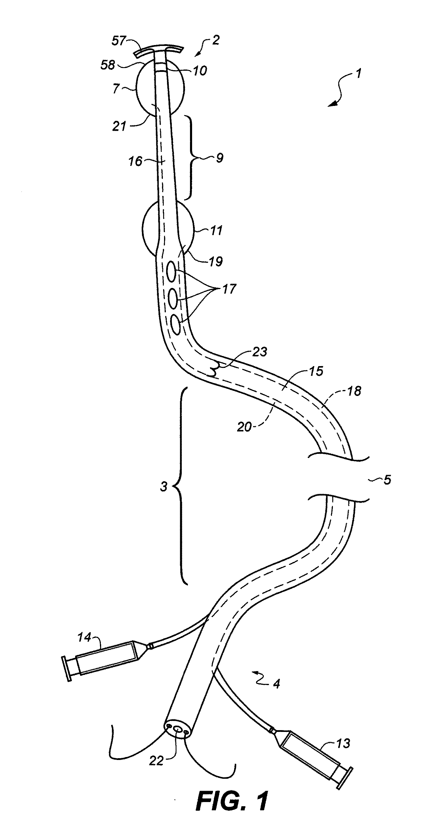 Endovascular catheter with multiple capabilities