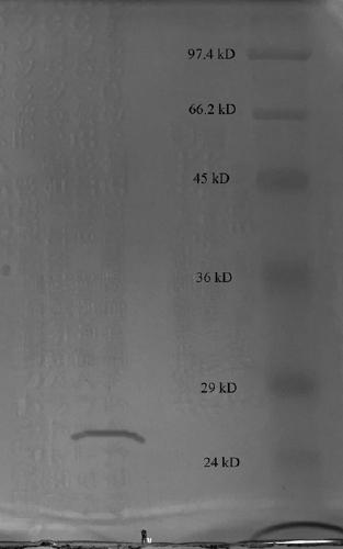 A kind of bacillus, the method of using bacillus to produce plasmin and the application of plasmin in thrombolytic drugs