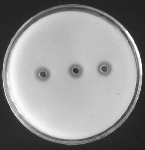 A kind of bacillus, the method of using bacillus to produce plasmin and the application of plasmin in thrombolytic drugs