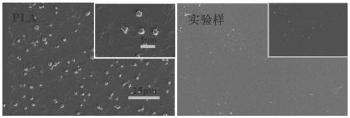 Multifunctional stent coating based on recombinant human collagen and preparation method of multifunctional stent coating