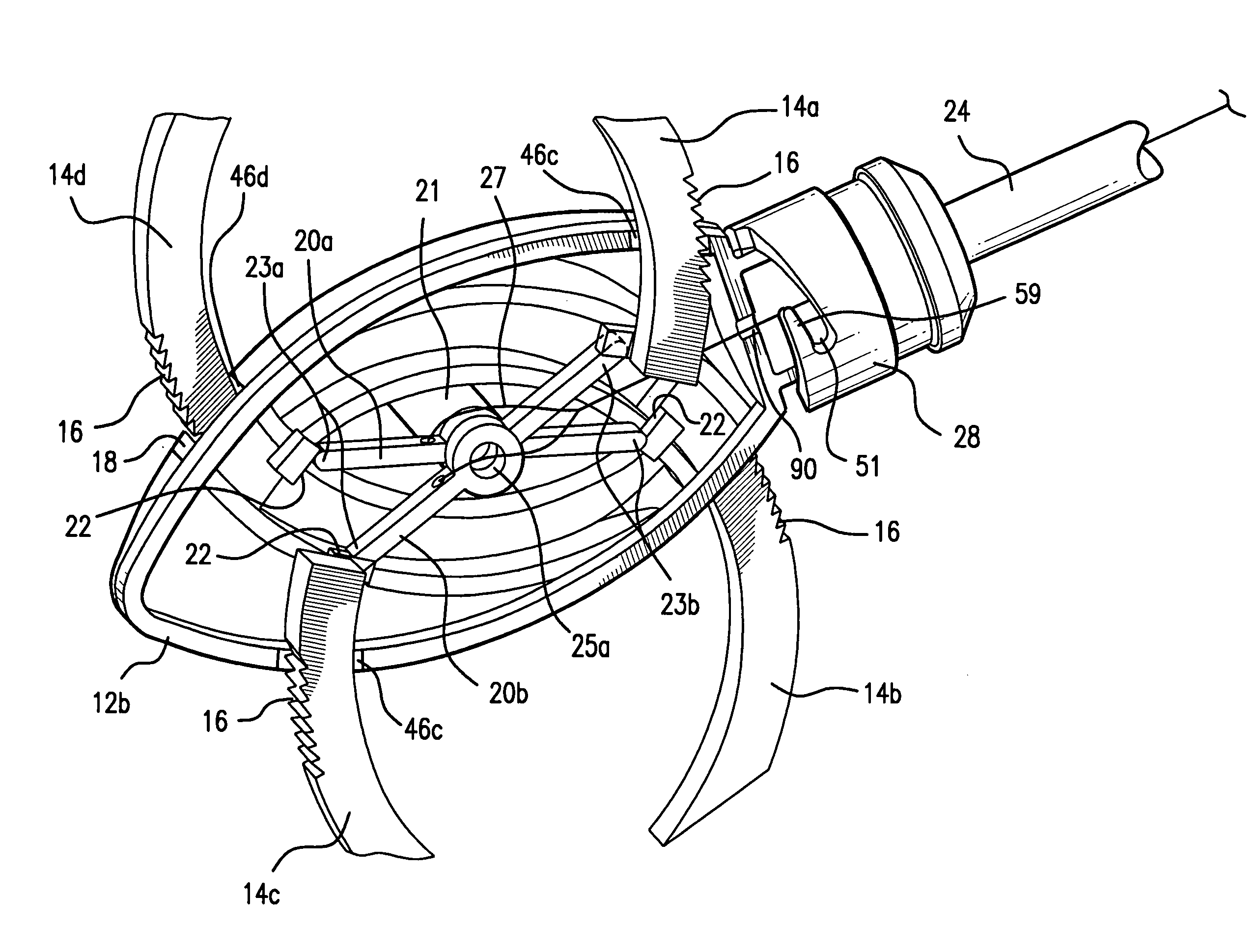 Interspinous implants and methods for implanting same