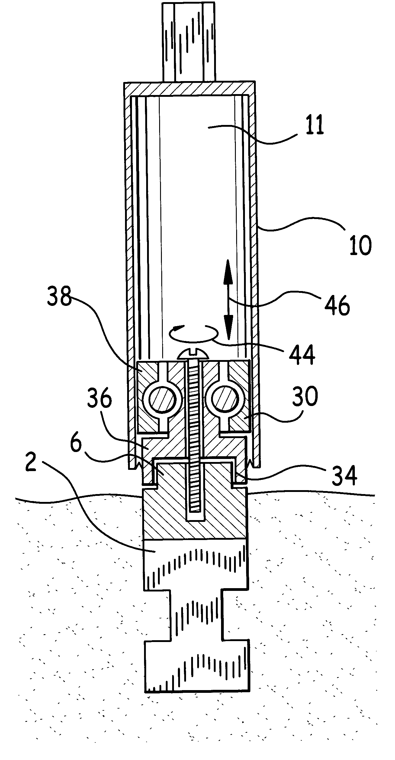 Apparatus and method to remove dental implant