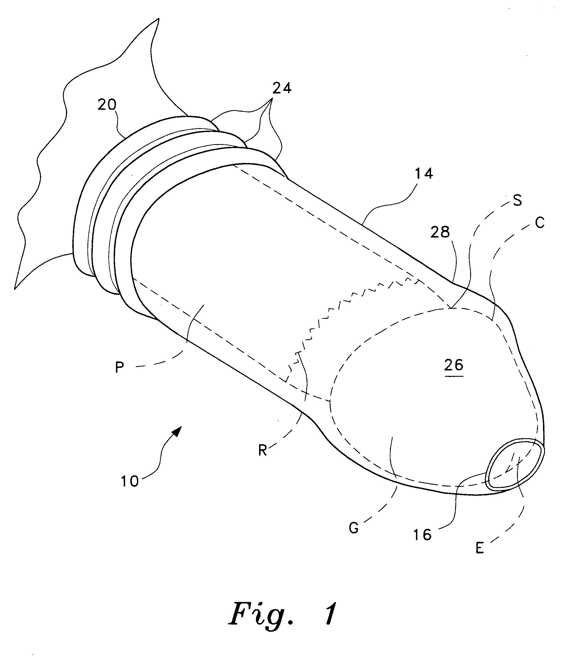 Foreskin prosthesis