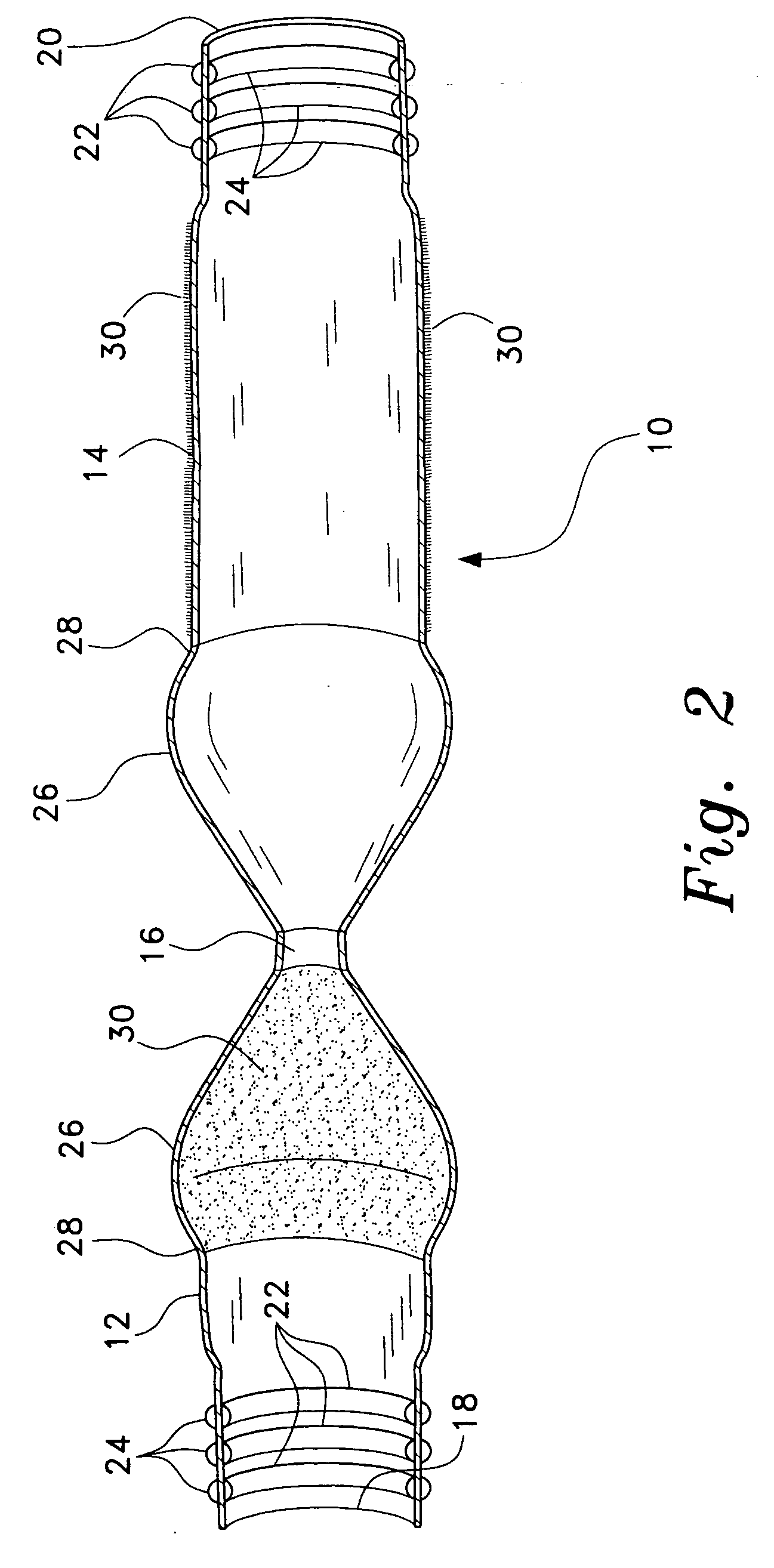 Foreskin prosthesis