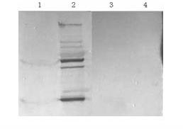 Preparation method of trichina and tumor related protein gene and medical application