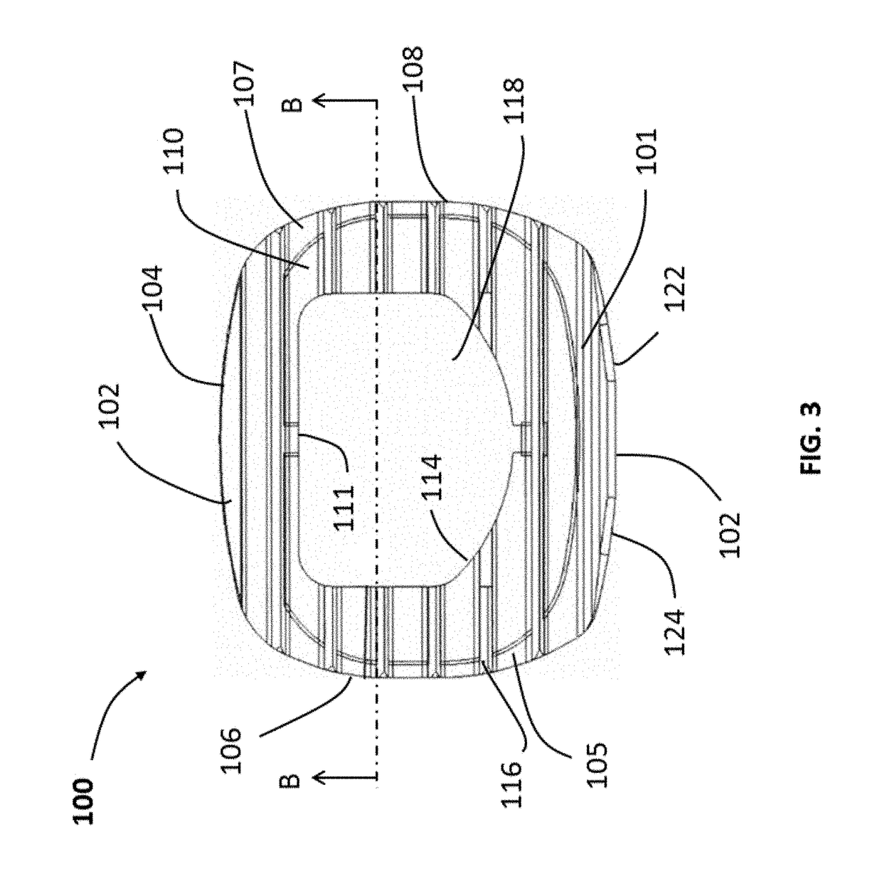 Spinal implants