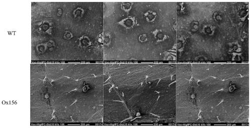 Application of miR156 and related biomaterial thereof in regulating disease resistance of plants