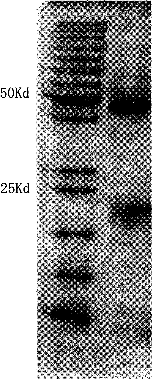 Anti-human Delta like4 monoclonal antibody