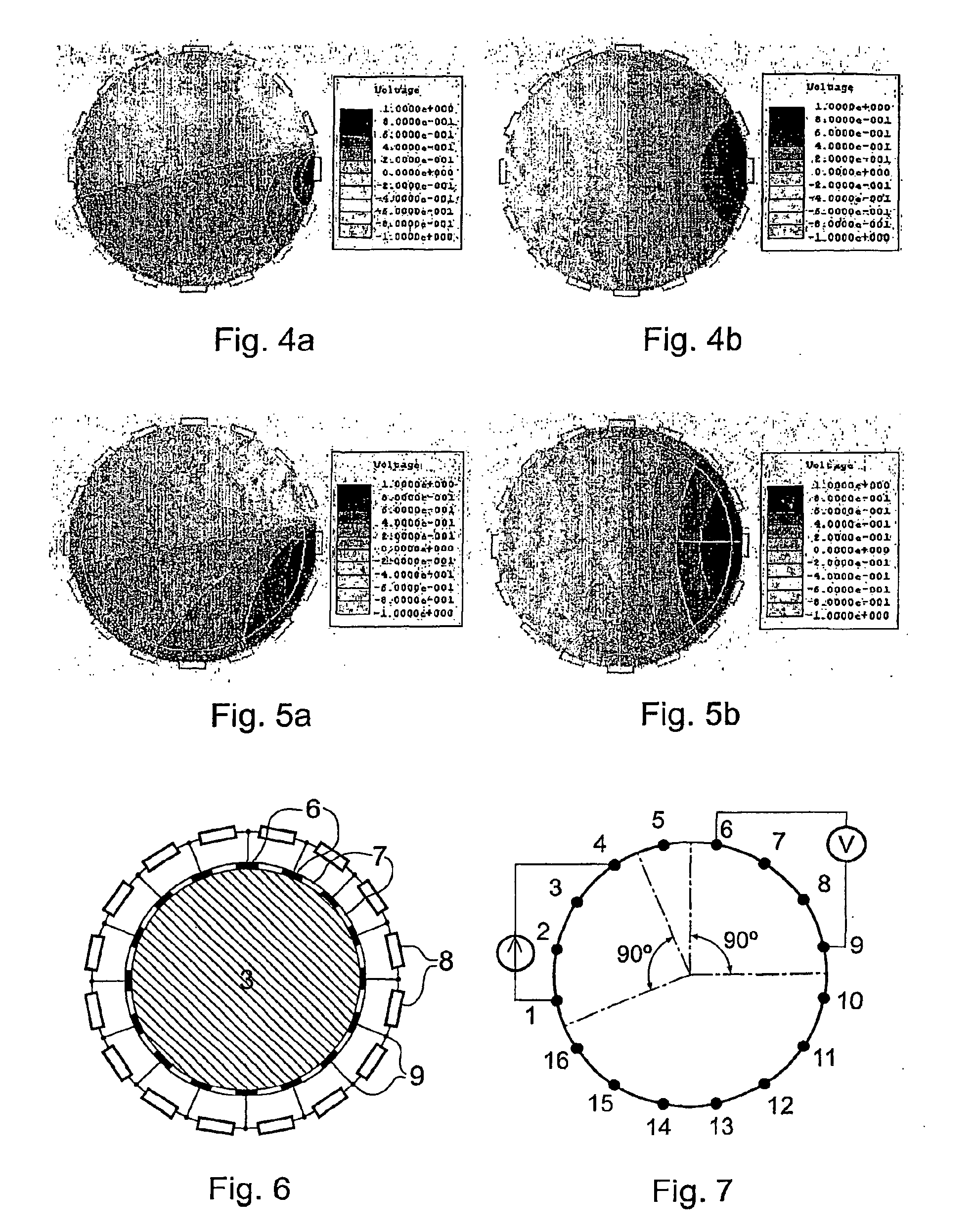 Electrical impedance tomography