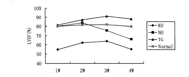 Human myocardium protecting gene and uses thereof