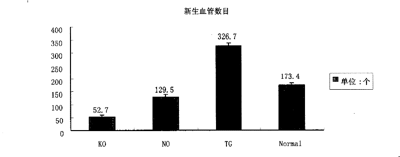 Human myocardium protecting gene and uses thereof