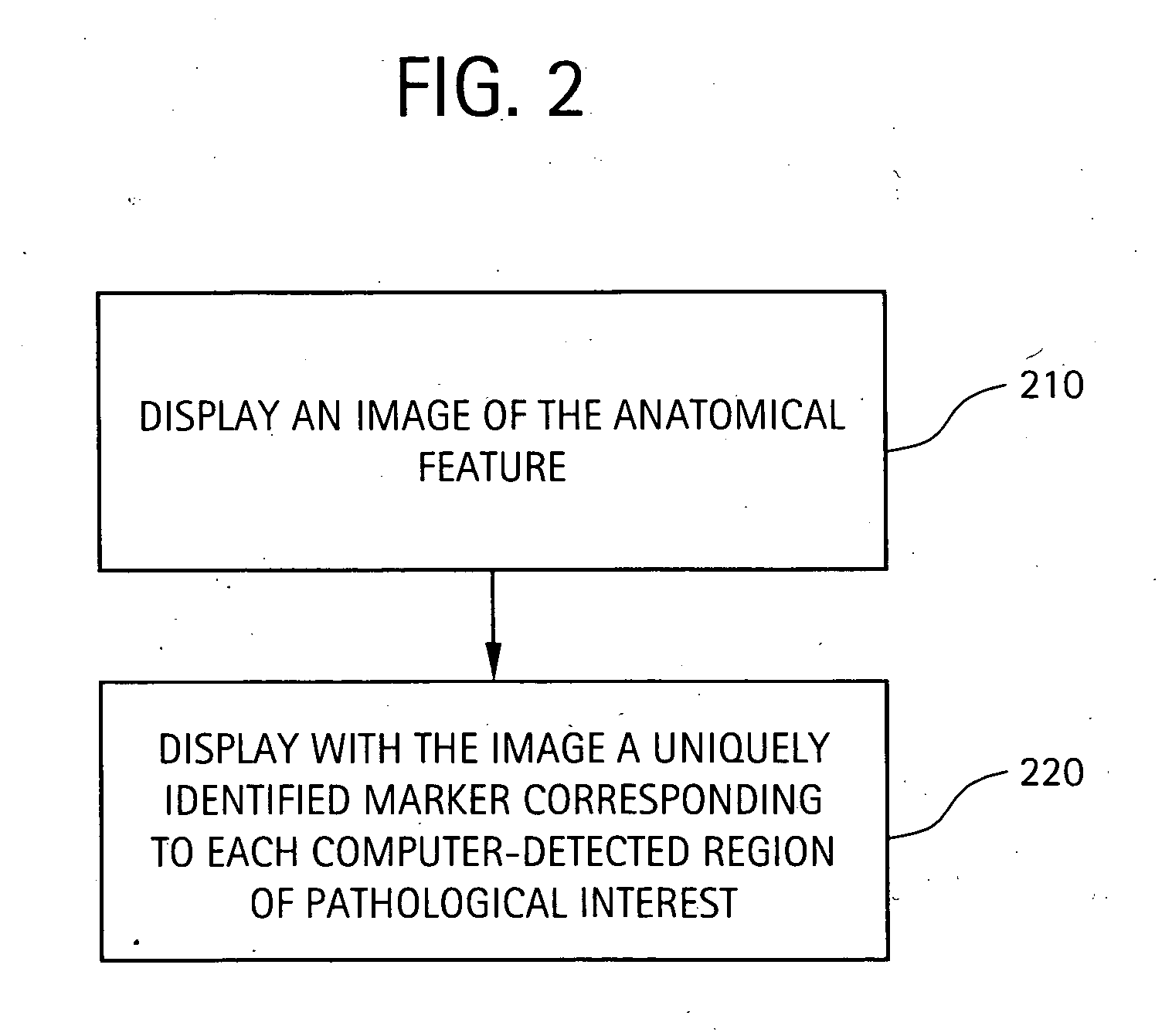 Method and system for displaying regions of pathological interest