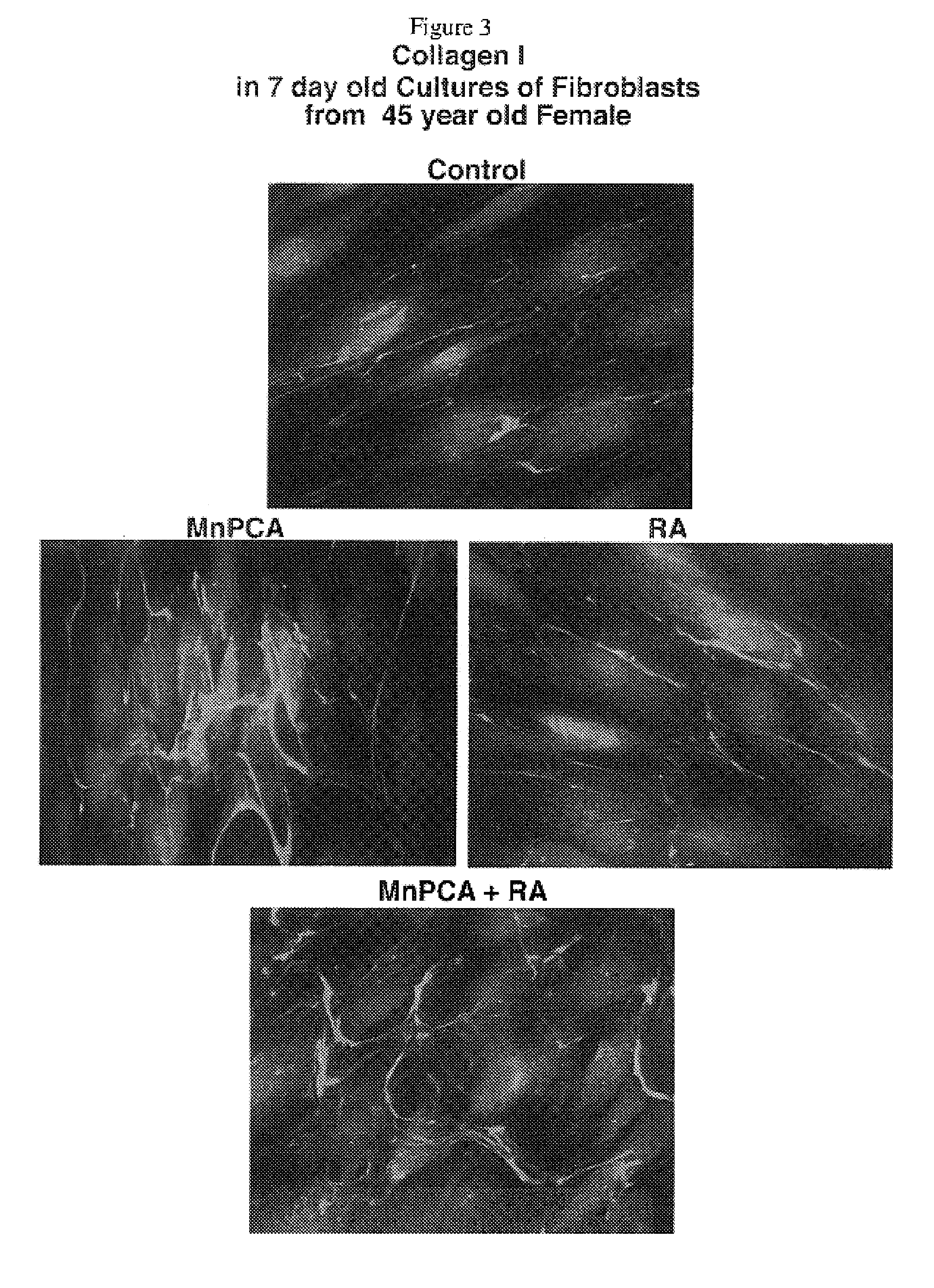 Compositions for elastogenesis and connective tissue treatment