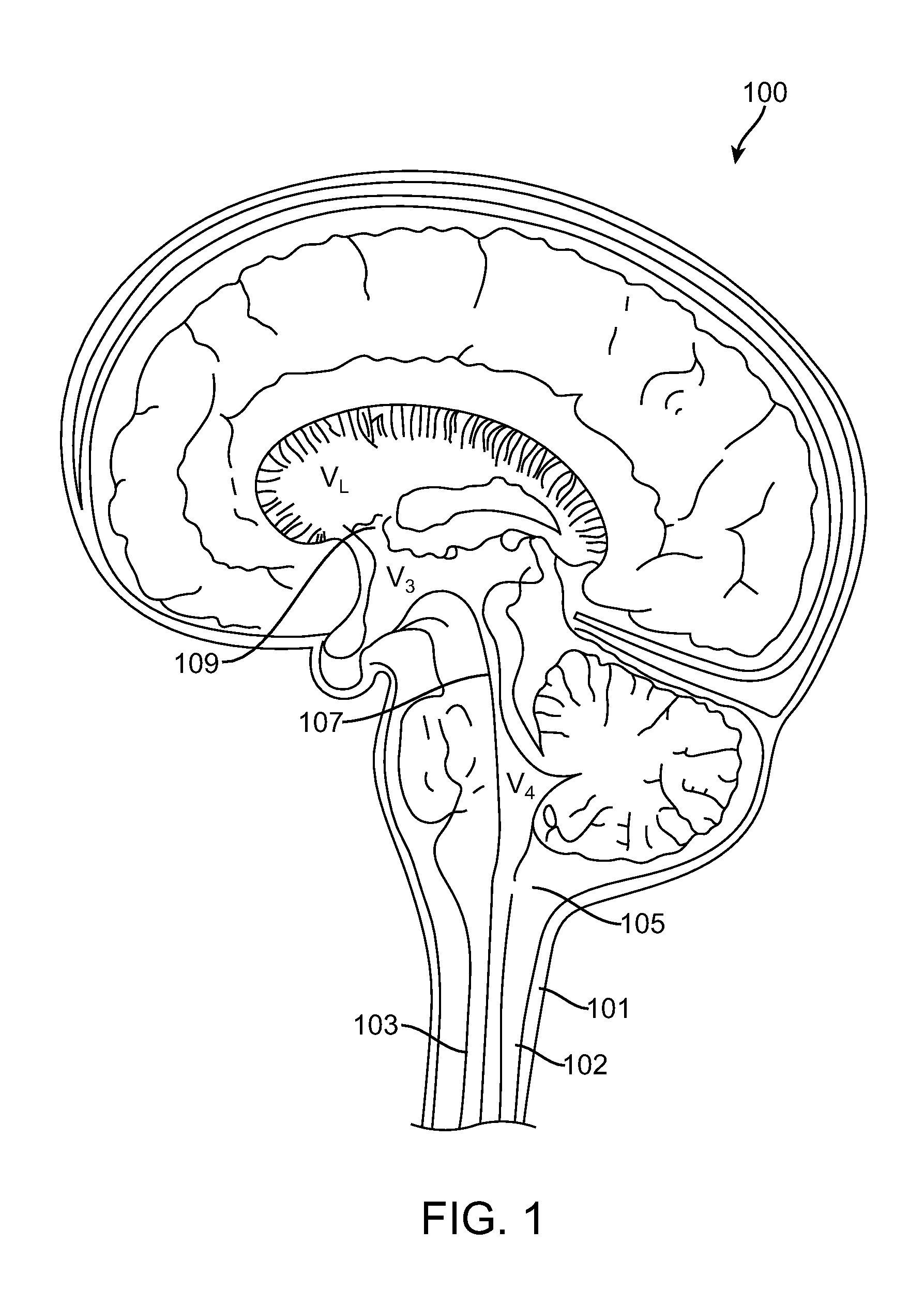 Methods for Simultaneous Injection and Aspiration of Fluids During a Medical Procedure