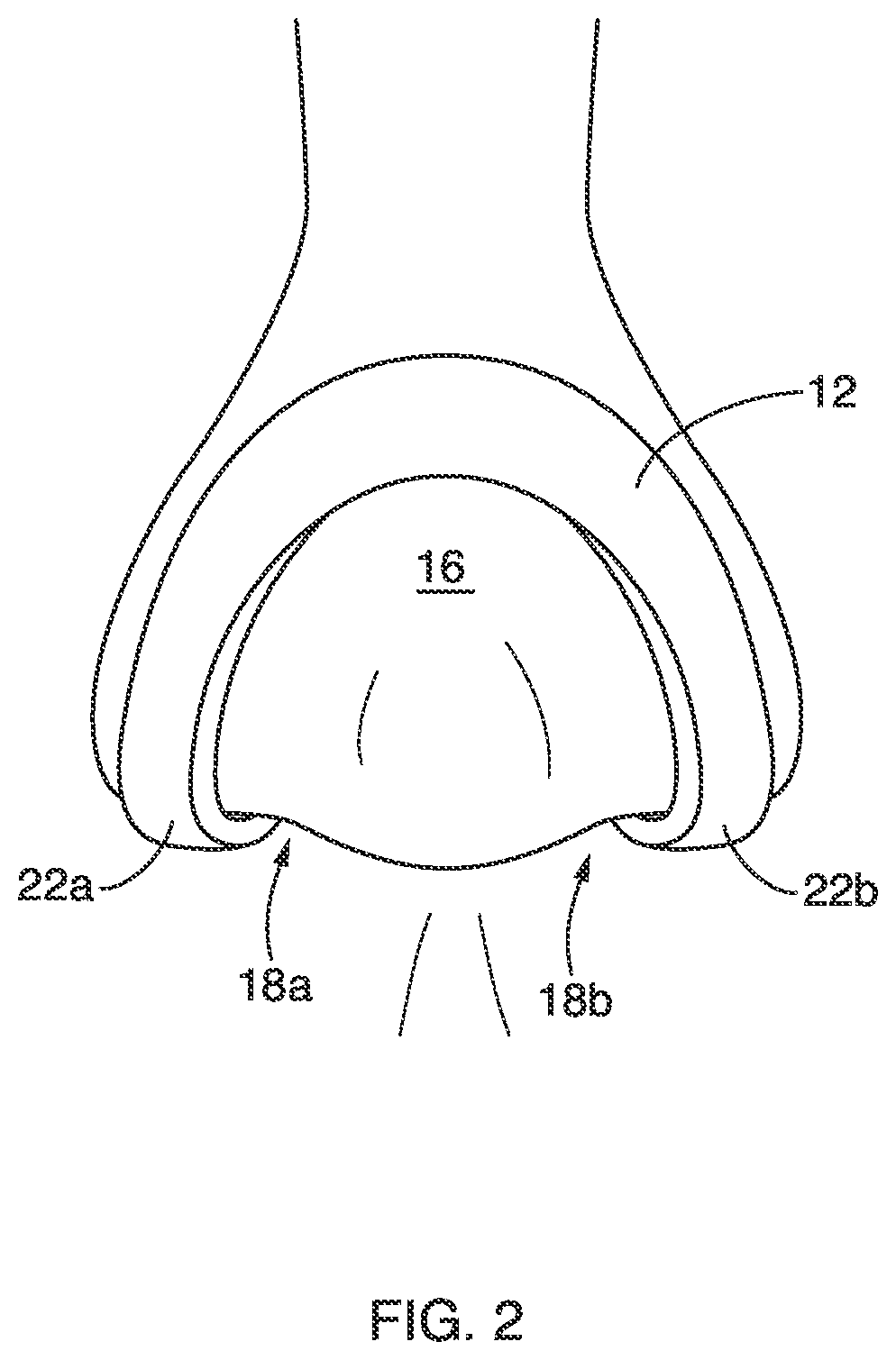 Nasal device for improving nasal breathing