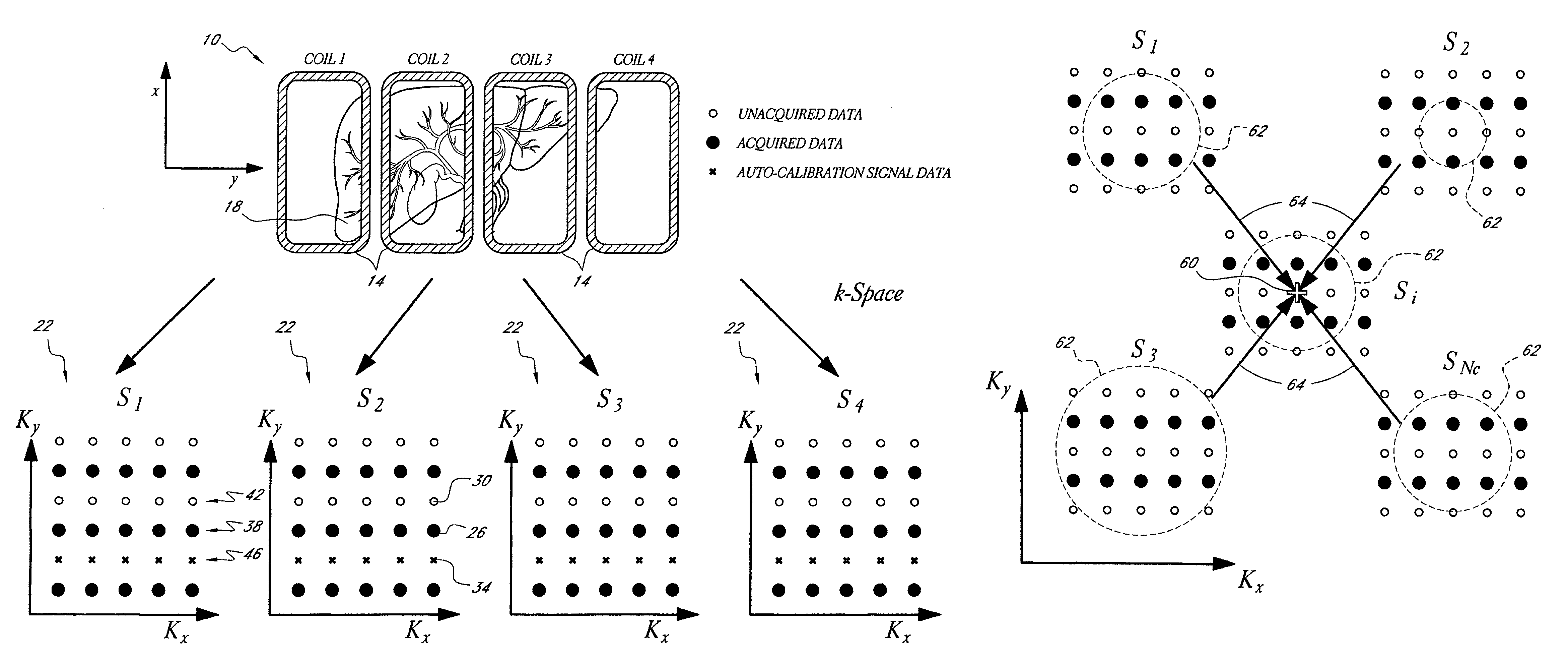 Systems and methods for image reconstruction of sensitivity encoded MRI data