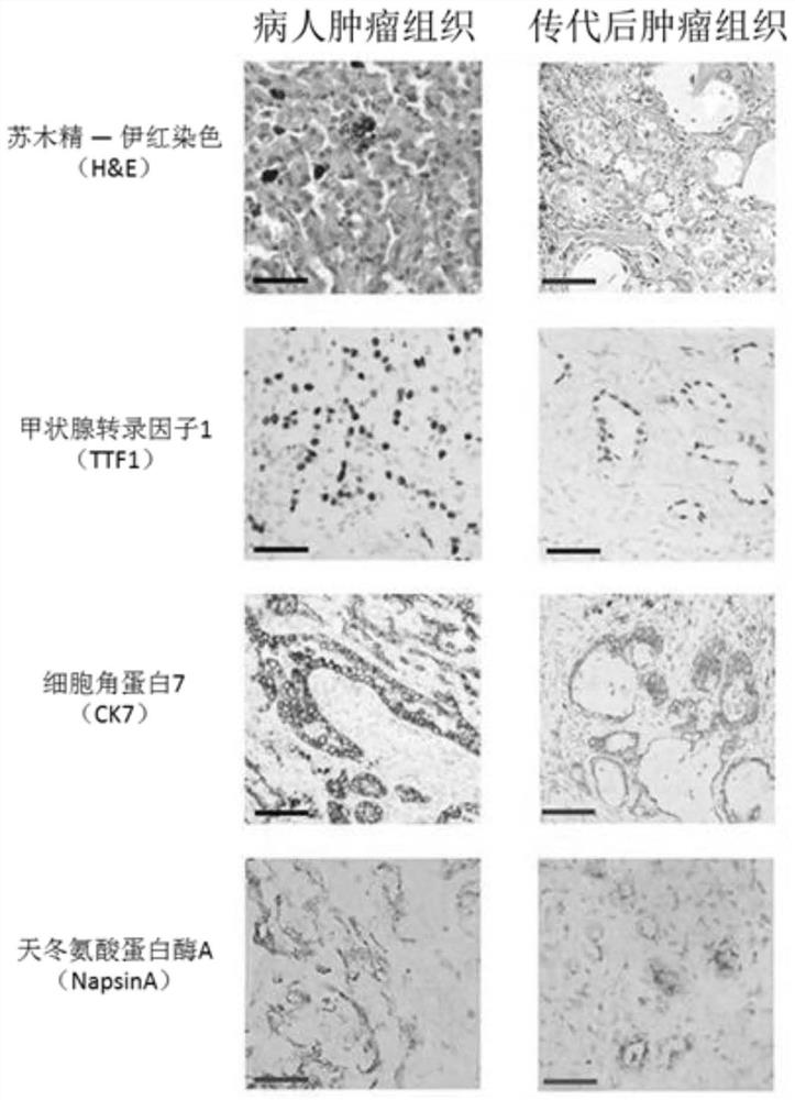 A mouse model of circulating tumor cells, its construction method and application