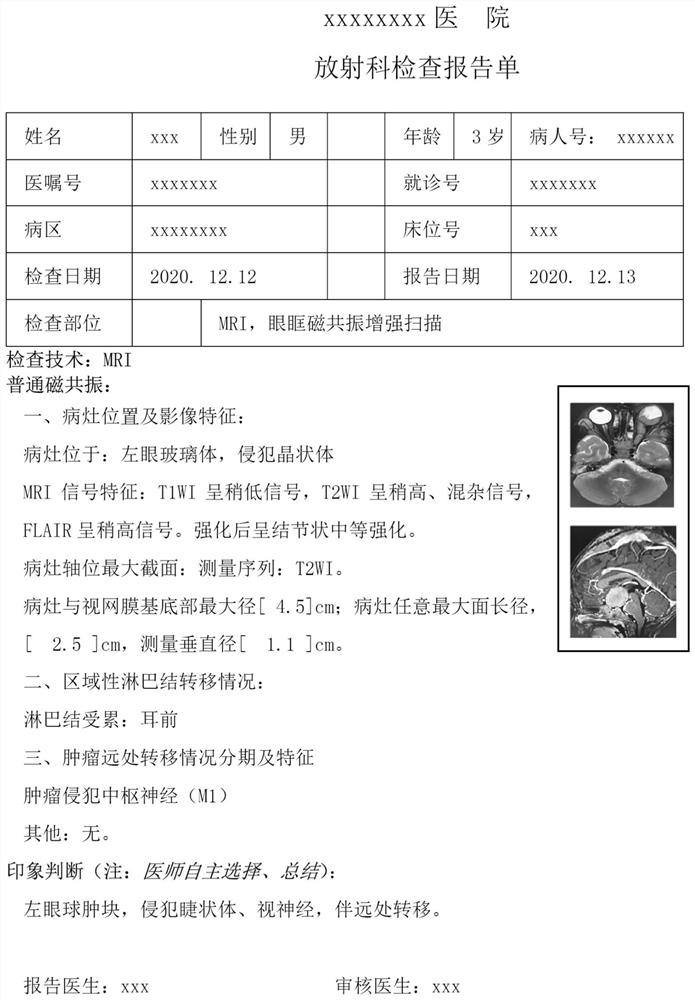 Intravitreal tumor image result output system and method