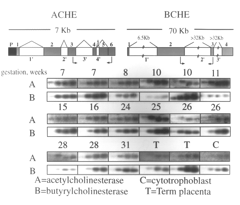 Method of screening for genetic predisposition to anticholinesterase therapy