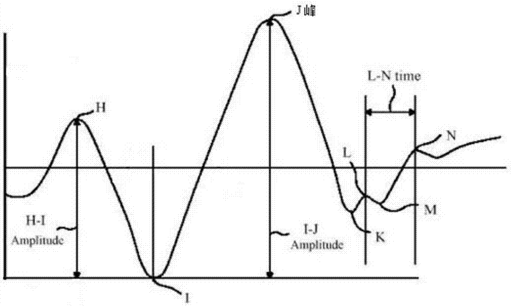 Method and application for acquiring HRV based on piezoelectric sensor