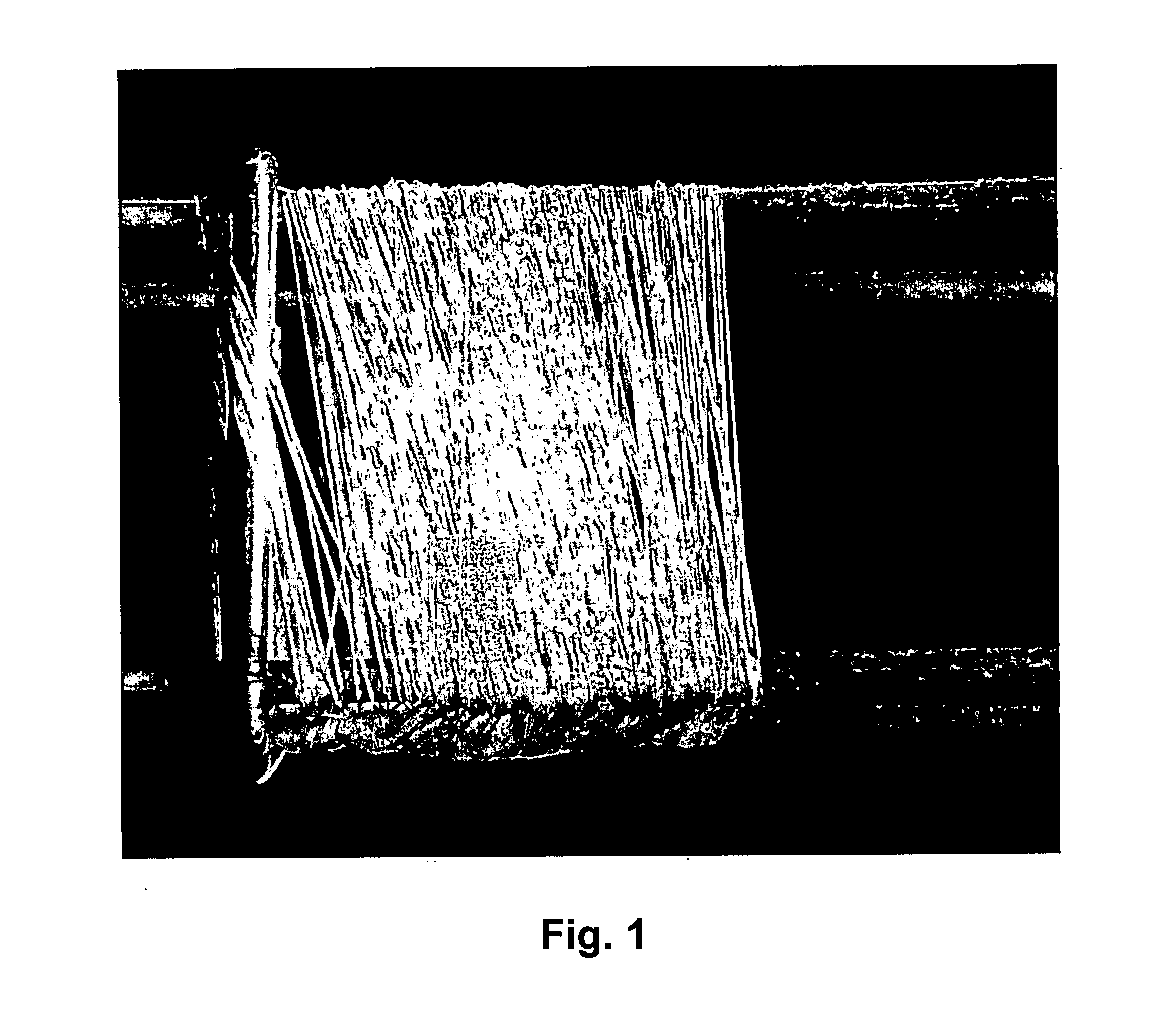 Hyaluronan fibres, method of preparation thereof and use thereof