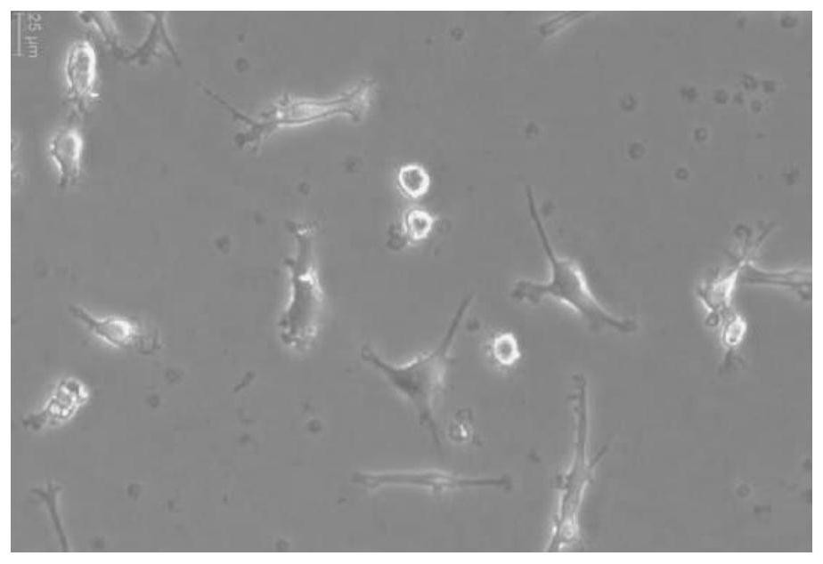 A kind of construction method of afft1 cell