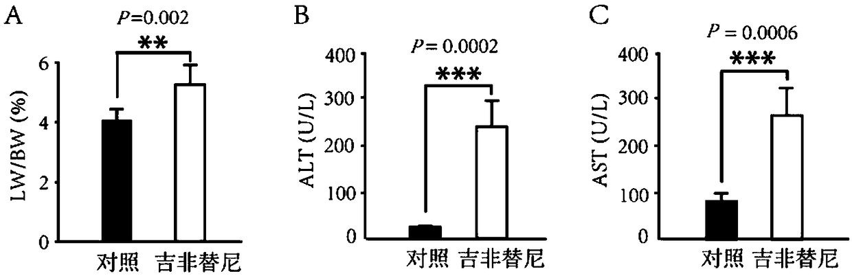 Application of composition in preparation of drug for inhibiting gefitinib hepatotoxicity