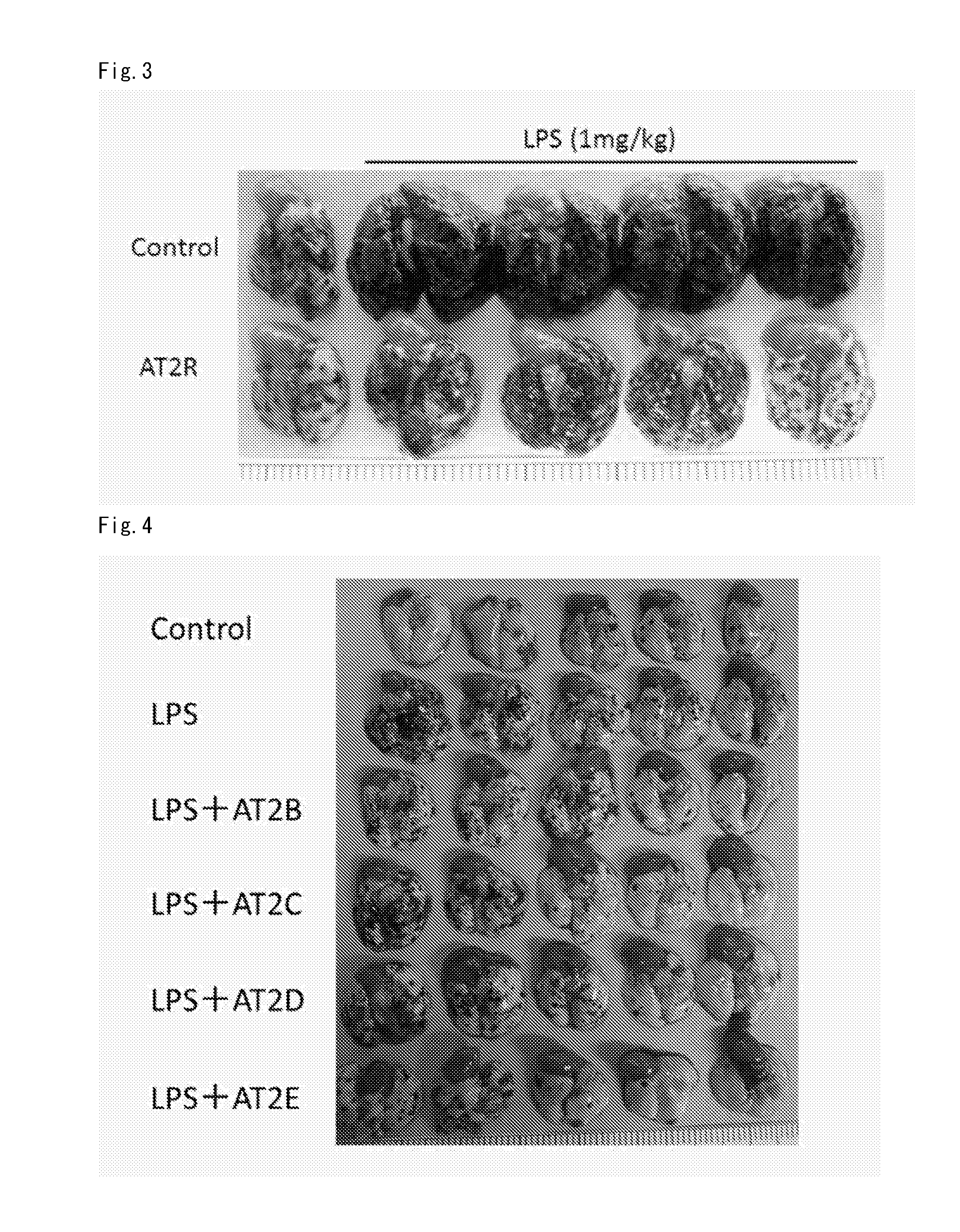 Medicament for suppressing malignant tumor metastasis