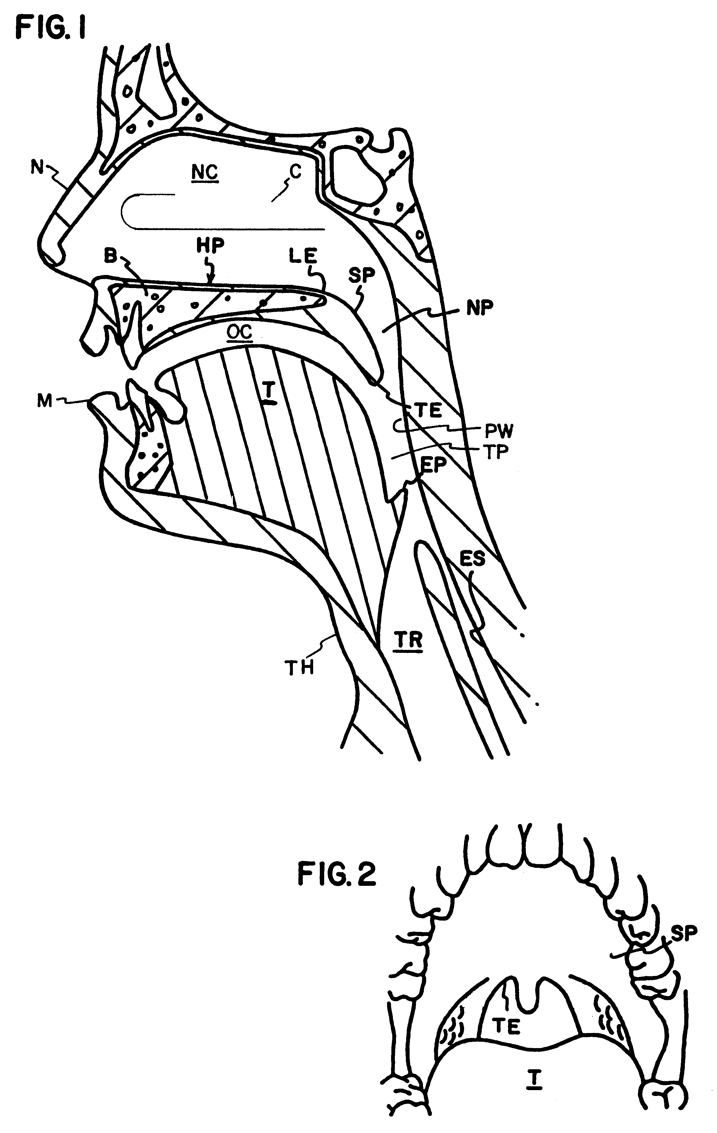 Snoring diagnostic and treatment