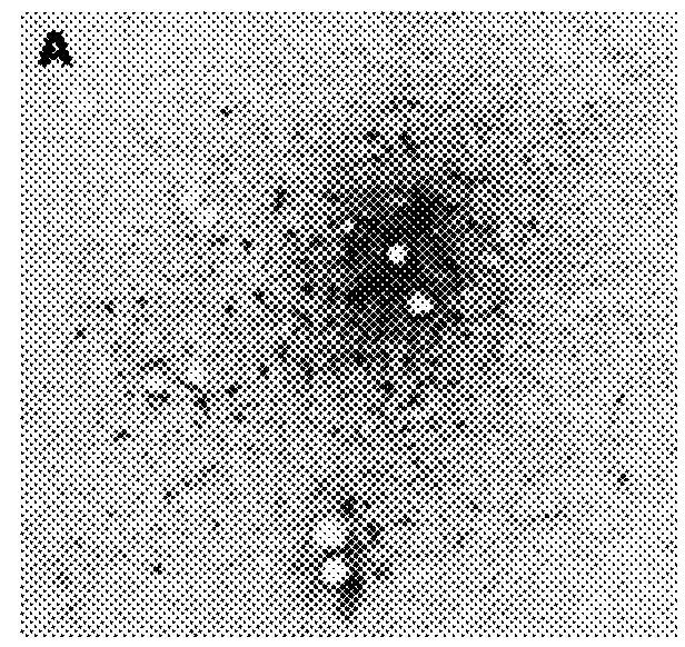 Method for preventing and/or treating chronic traumatic encephalopathy-iv