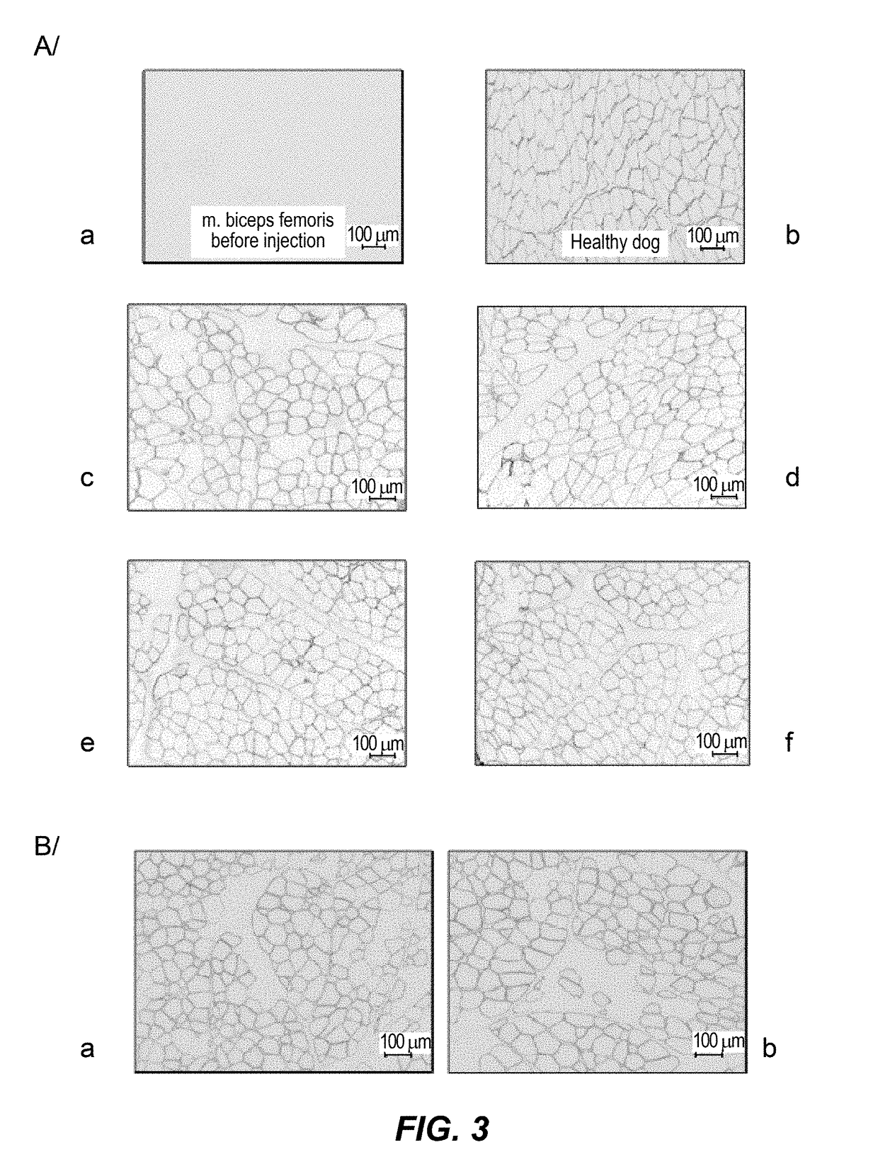 Efficient systemic treatment of dystrophic muscle pathologies