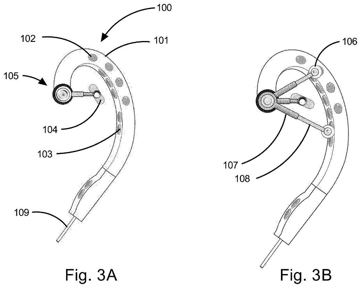 Multimodal Transcutaneous Auricular Stimulation System Including Methods and Apparatus for Self Treatment, Feedback Collection and Remote Therapist Control