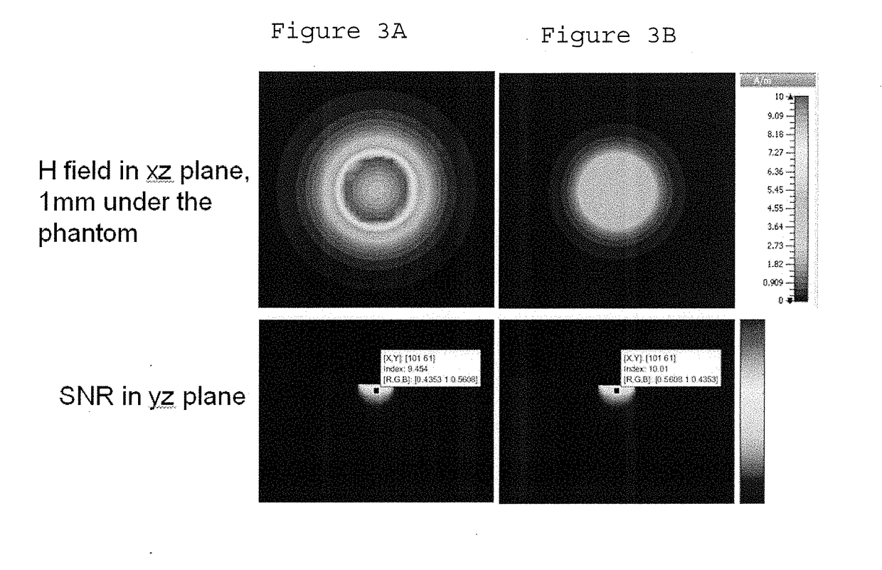 Receive coil arrangement and method for use thereof