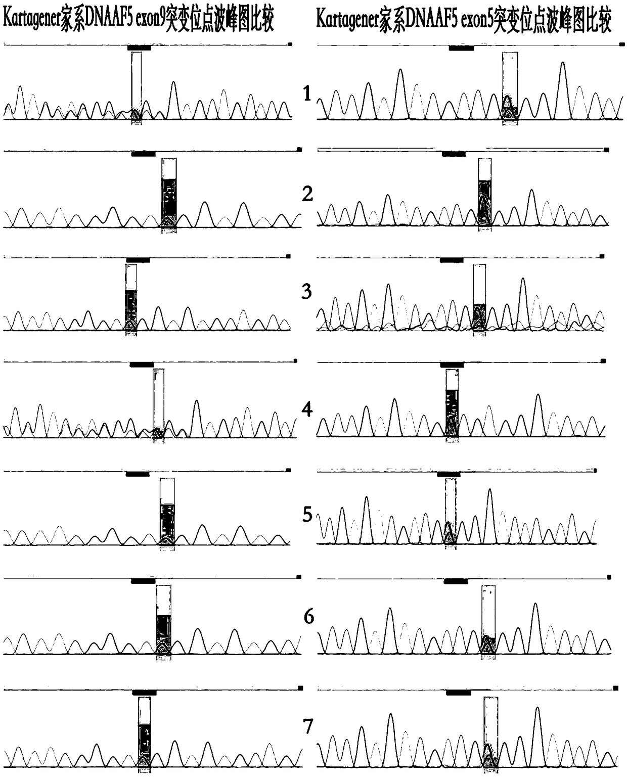 Autosomal recessive heredity Kartagener syndrome mutant gene and application thereof