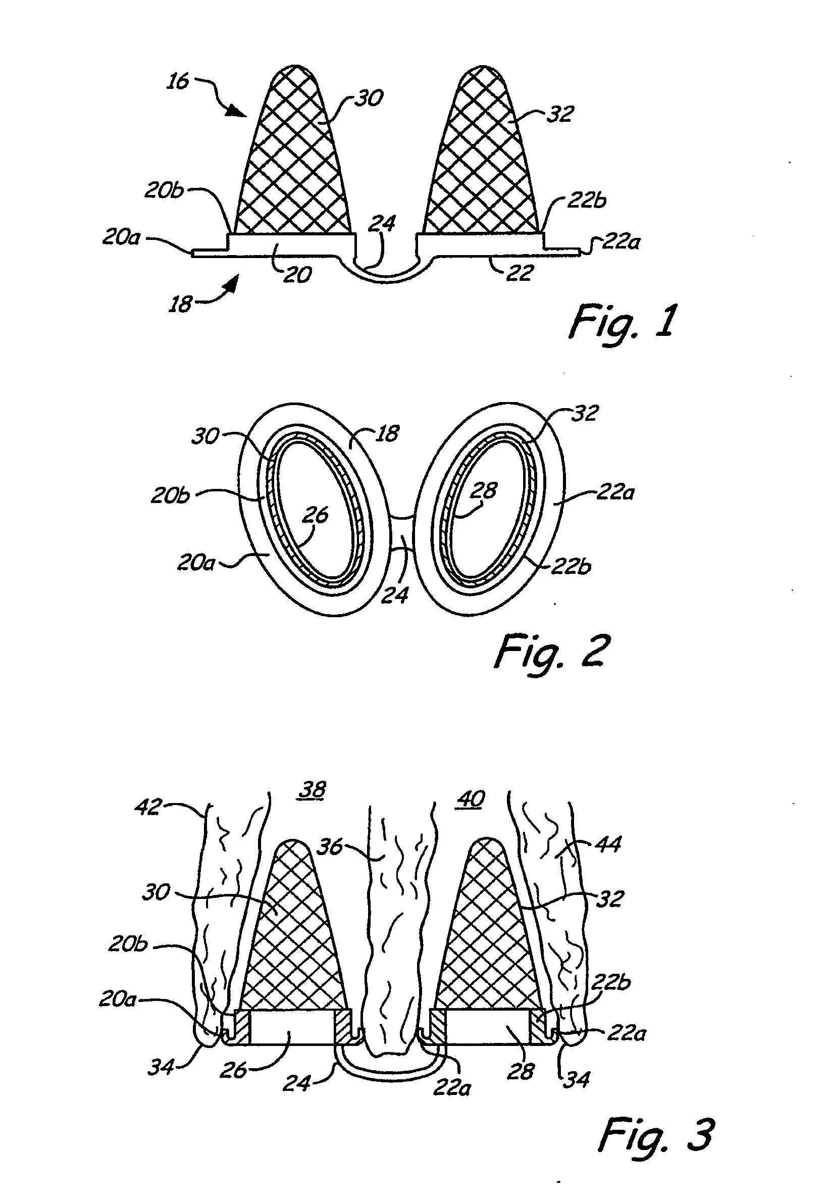 Breathing air filtration devices