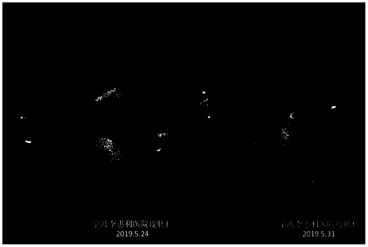 Composition for regulating microecological balance of skin and preparation method of composition