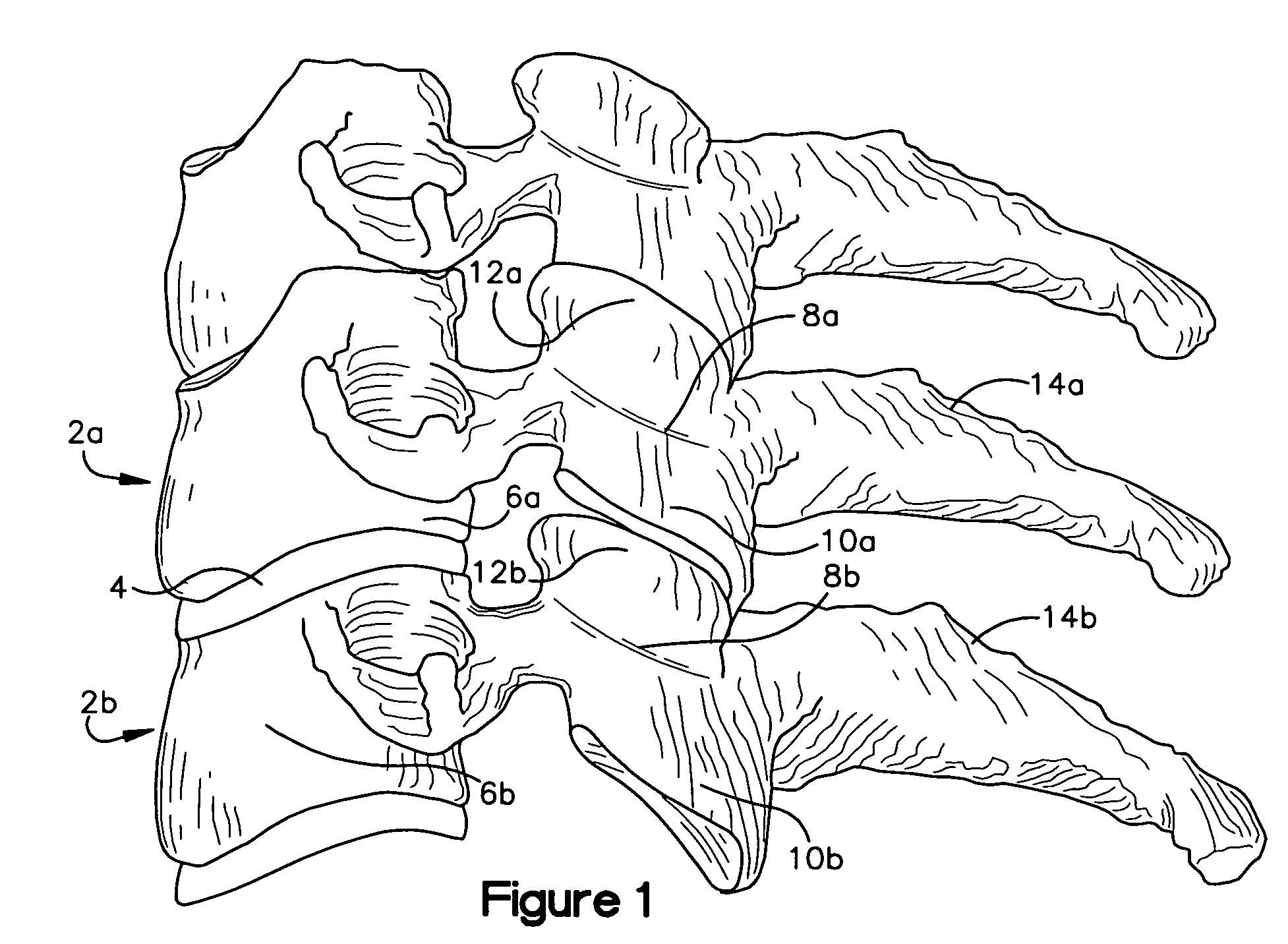 Artificial spinal disc