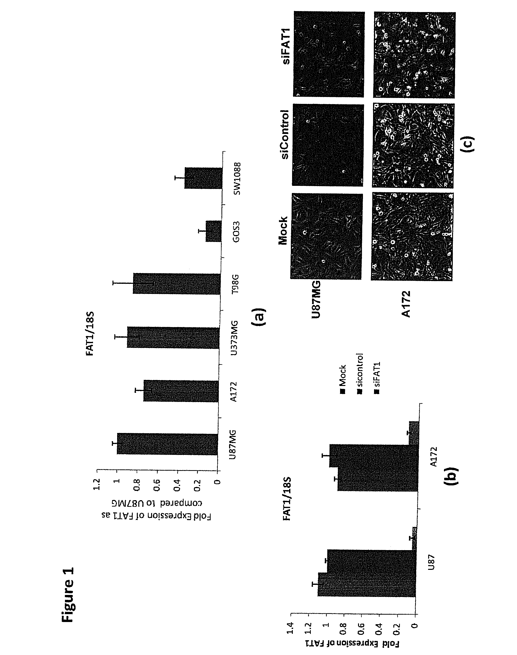 Fat1 gene in cancer and inflammation