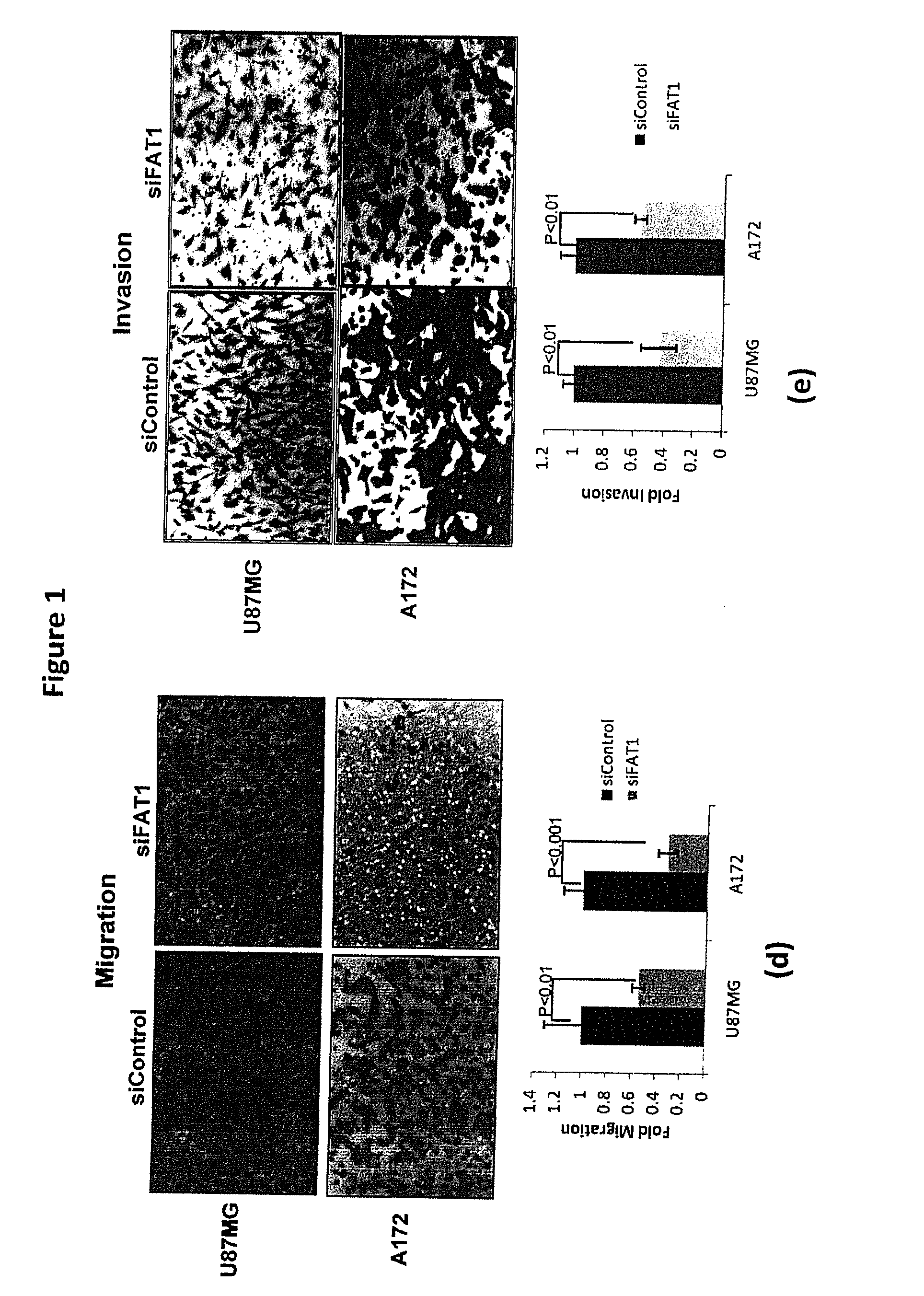 Fat1 gene in cancer and inflammation