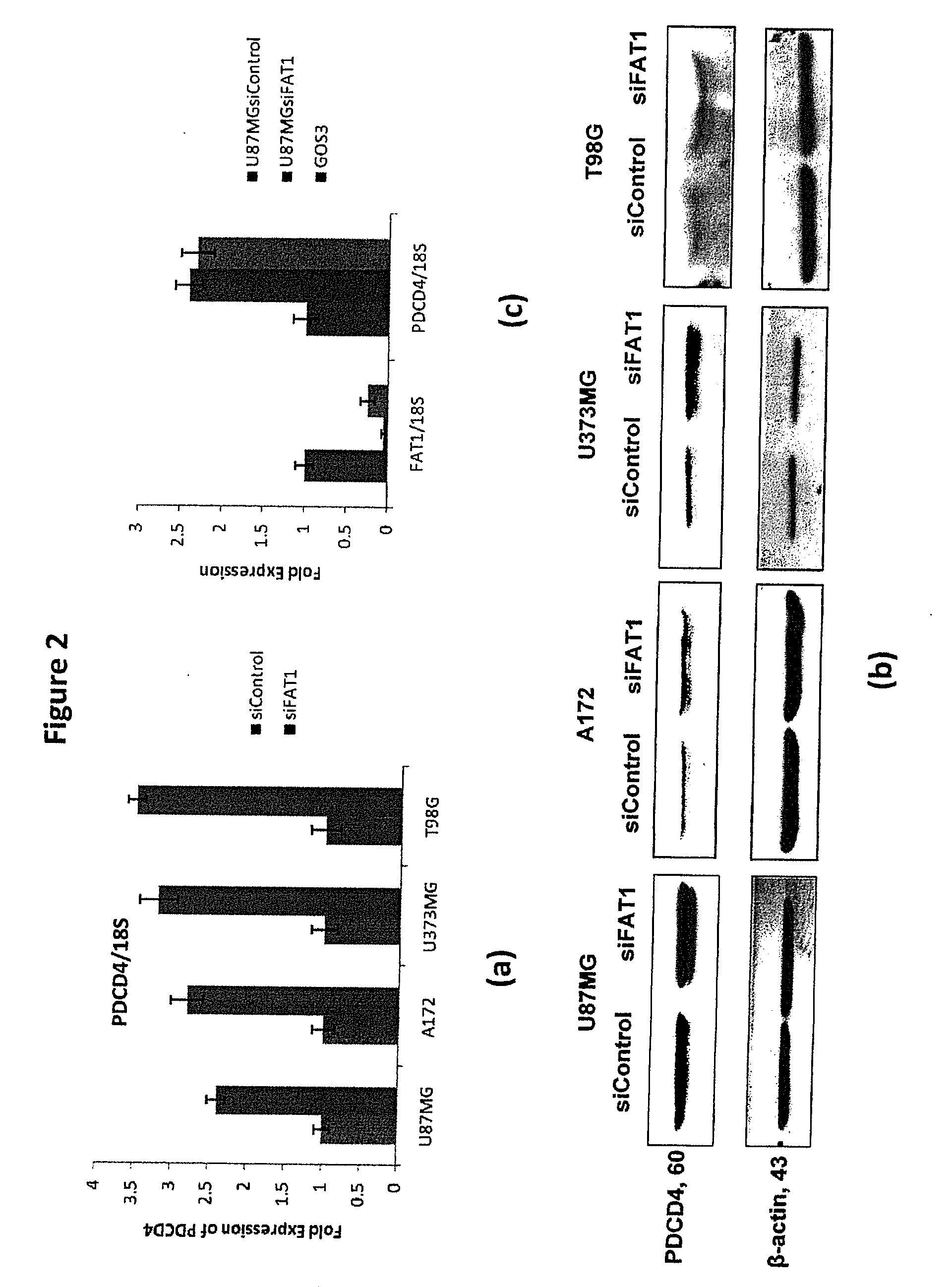 Fat1 gene in cancer and inflammation