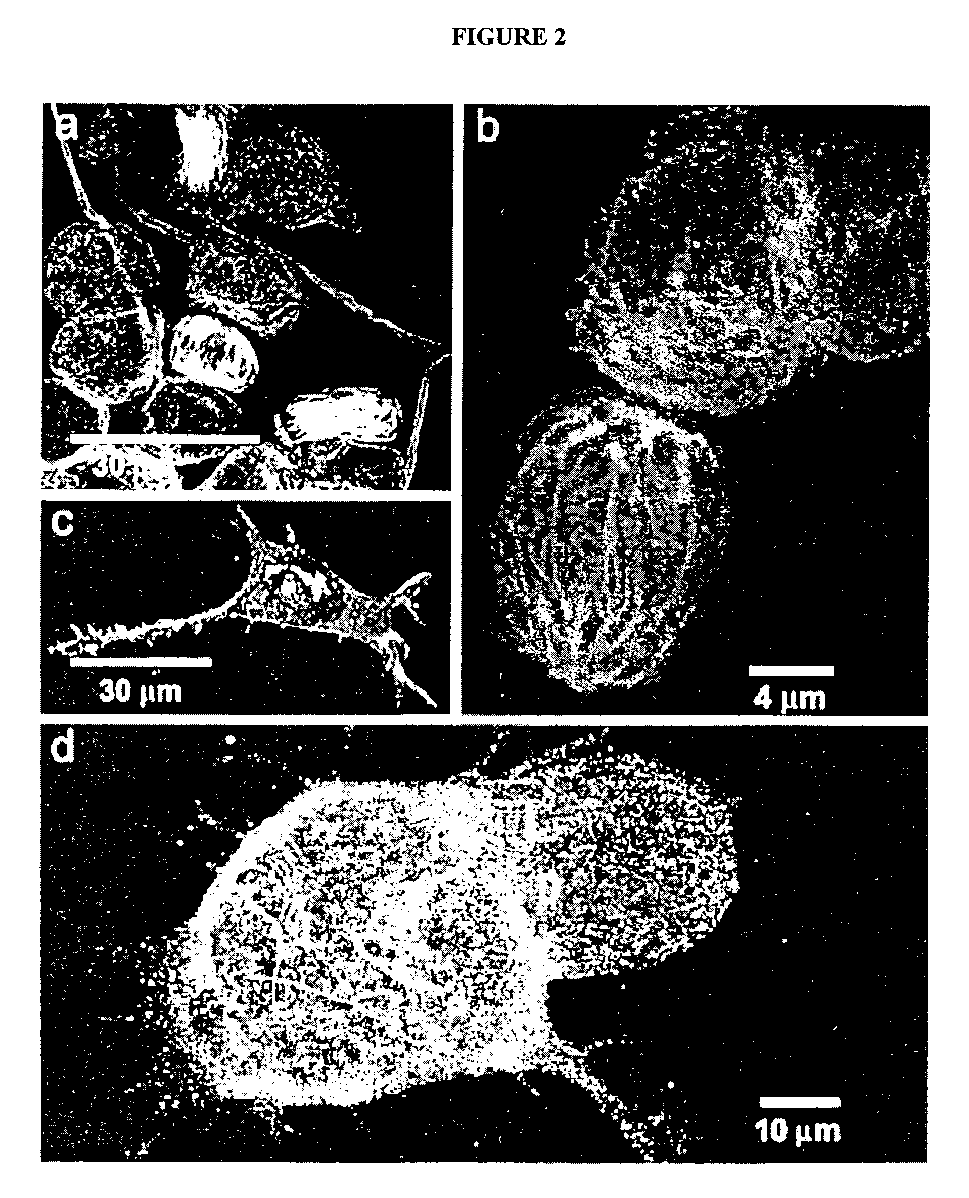 Methods for obtaining adult human olfactory progenitor cells